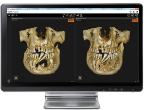 cs-3d-imaging-software-feature